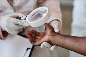 black skin cancer skincare atlanta
