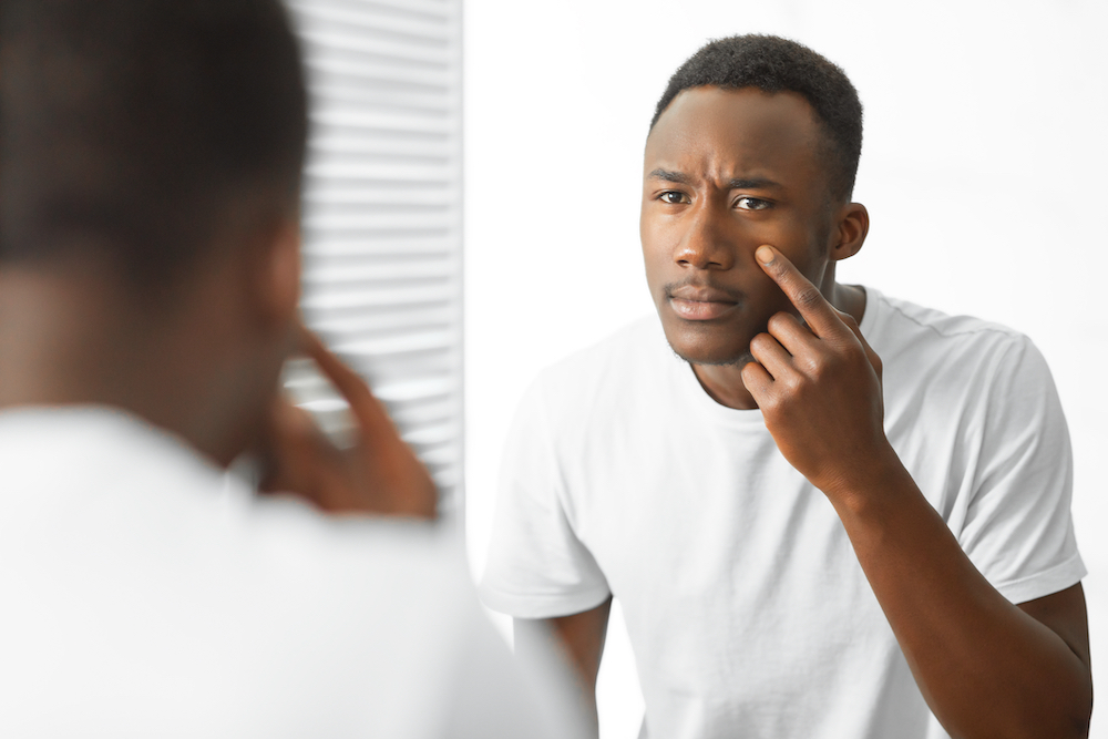 man looking at mole on face