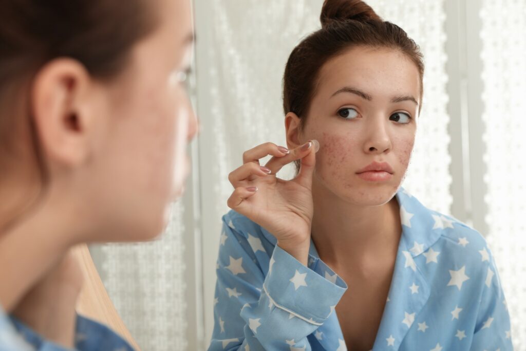 teen acne helped with dermatologist