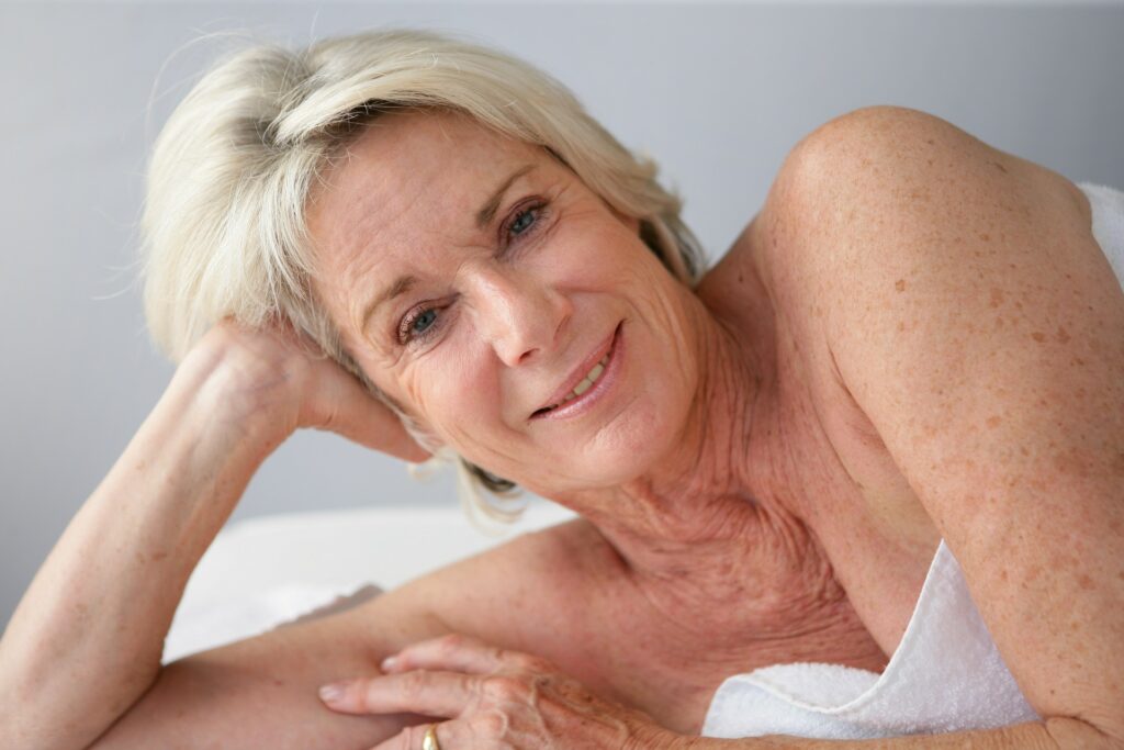 older white woman age spots