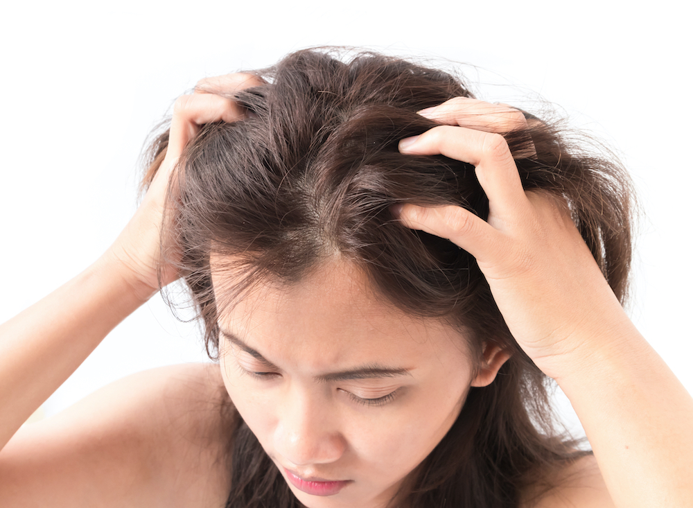 woman with itchy scalp